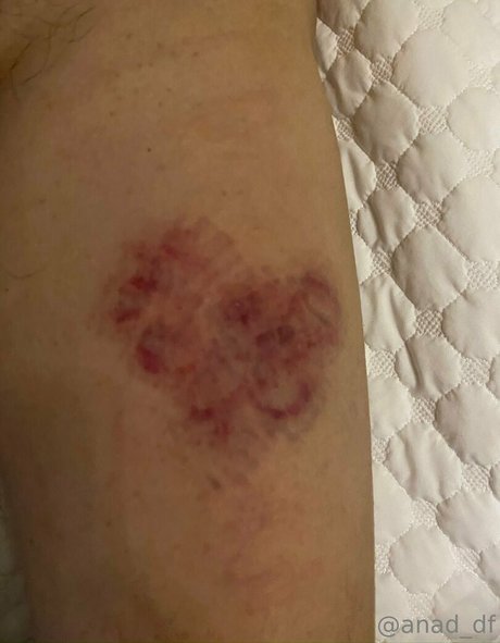 anad df 高品質のポルノスター 写真