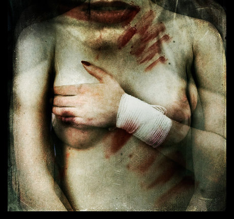 Monika Chmielecka 裸モデル 画像