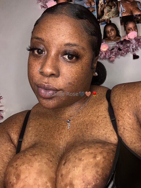 Freckledfantasy5 スター 裸 写真