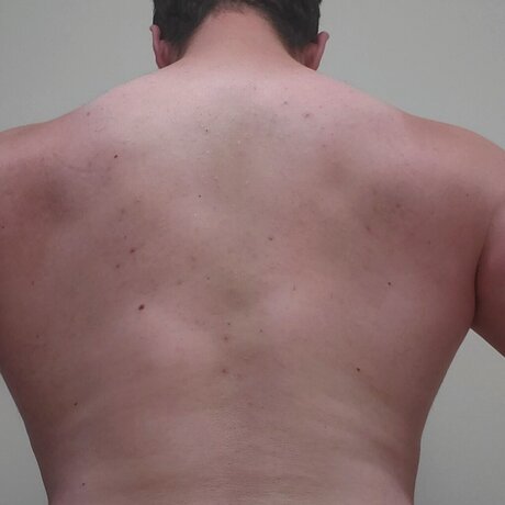 Andrew dennis トップモデル 写真