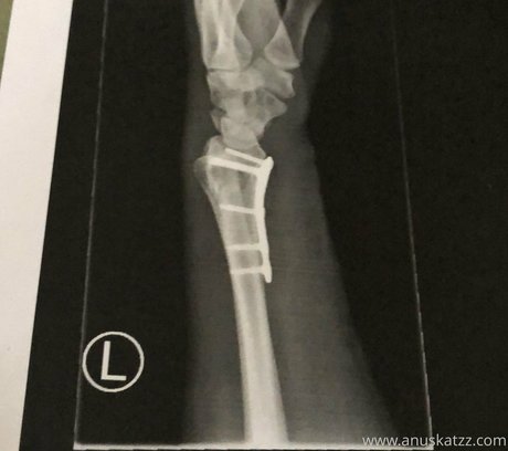 美しいOnlyFans 無料セクシー 画像