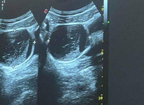 freemollypills XXXモデル 写真