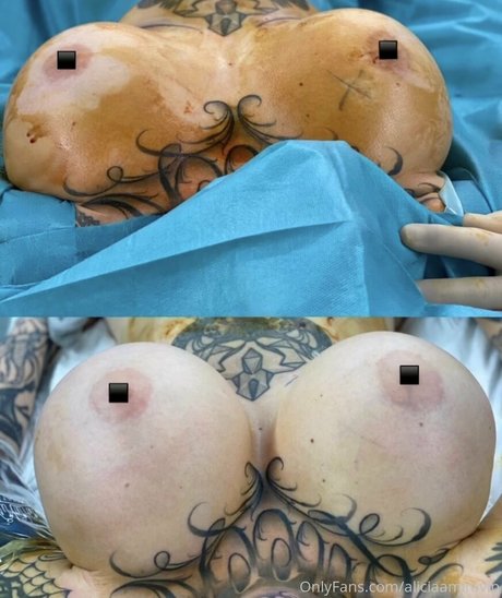 アナル無料OnlyFans 可愛い 画像