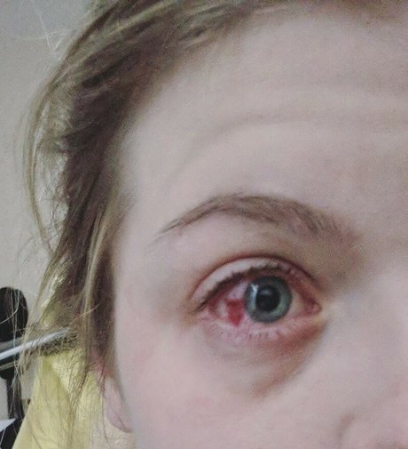 コスプレヌードOnlyFans ホットポルノ 写真