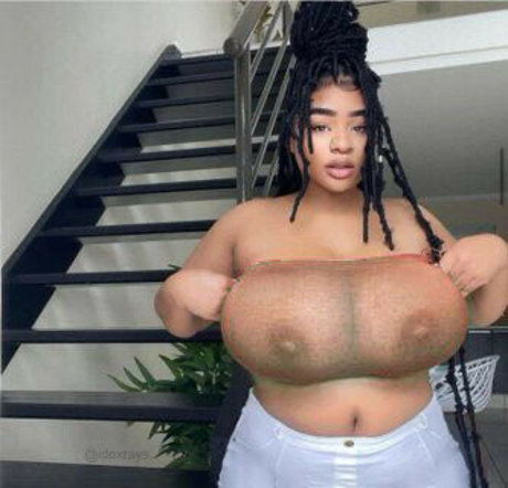 My Xray Work Neues OnlyFans