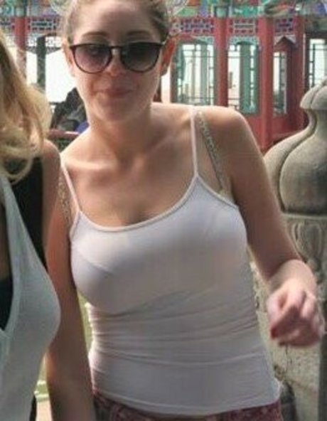 My Xray Work XXX Leak OnlyFans