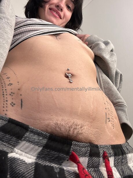 Mentallyillmile Leaked OnlyFans Nacktbilder