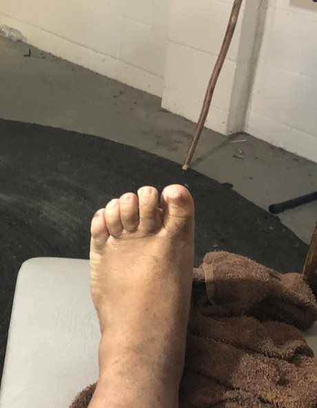 cherrykoolaid Nacktbilder von OnlyFans geleakt