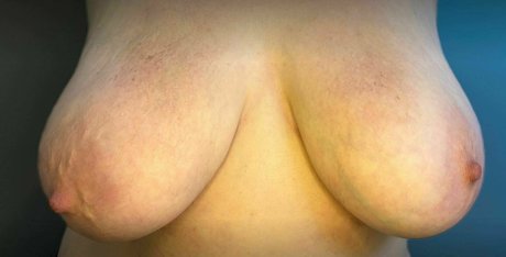 acidalexonly Nacktbilder von OnlyFans geleakt