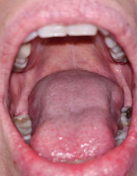 jackdaspeck OnlyFans kostenlos