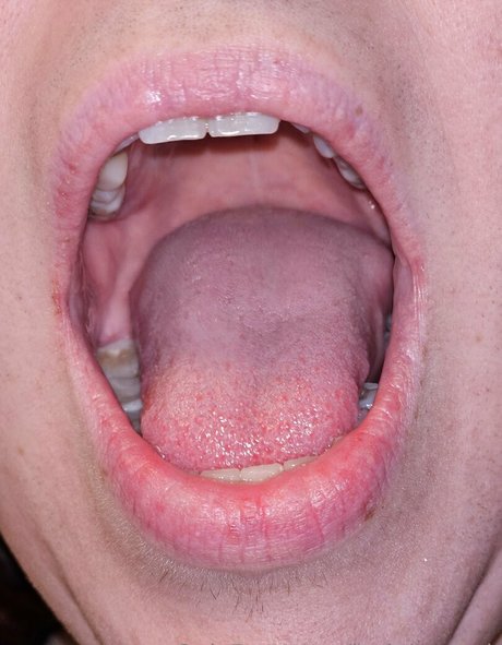 jackdaspeck NSFW OnlyFans