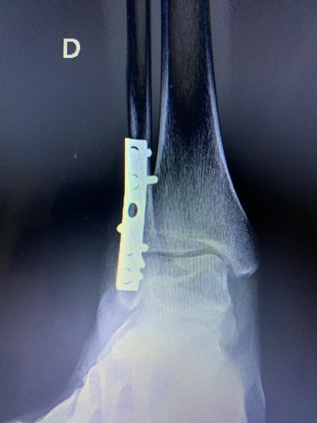 OxfordGold OnlyFans Gratis Porn