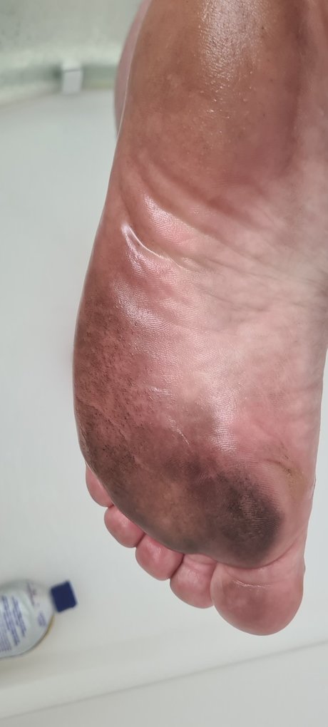 Philfeet OnlyFans Pornografie