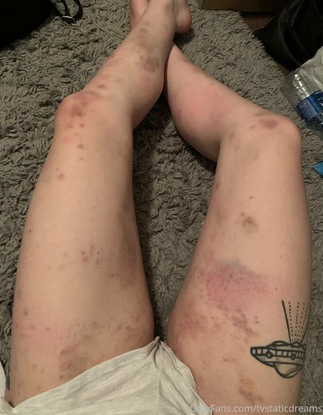 tvstaticdreams Profilbild