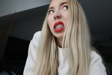 Kate in Braces Sextape OnlyFans Nacktbilder