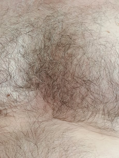 Harry Mann Leaks von Nacktbildern auf OnlyFans