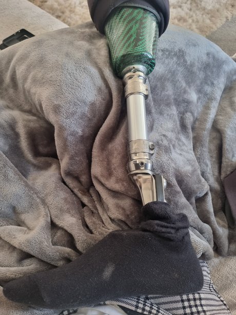 Stumpy OnlyFans Leak