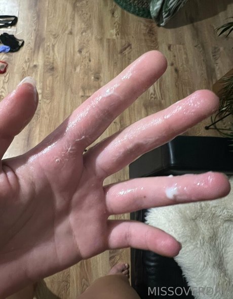 missoverdrip Leaks OnlyFans