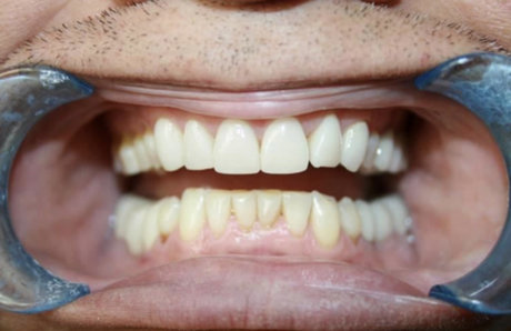 ToothFetish Doc OnlyFans geleakte Pornografie