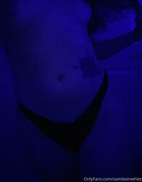 samitwinwhite OnlyFans geleakte Bilder