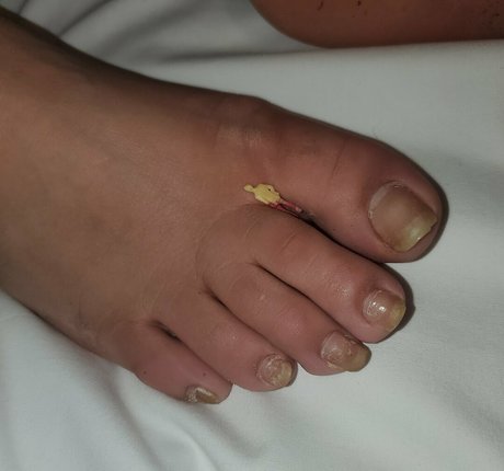 missfeetstinkvip Bilder OnlyFans