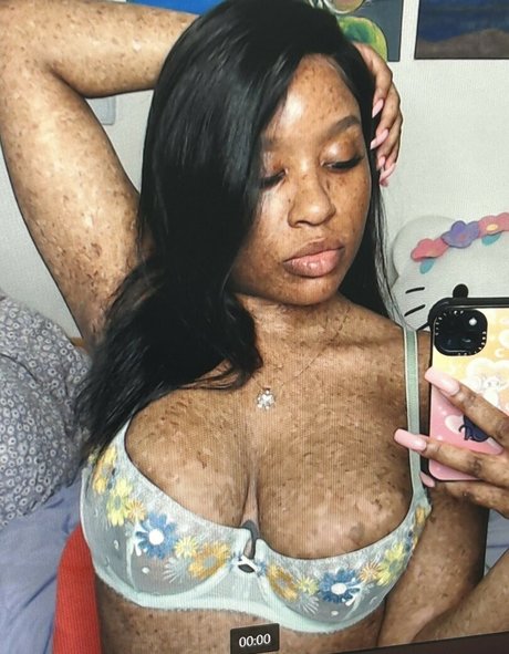 freckledn Nacktbilder-Leaks von OnlyFans