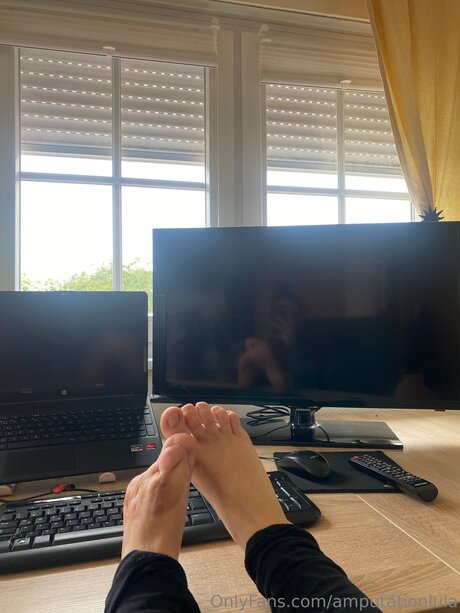 Amputationlula OnlyFans Pornografie geleakt