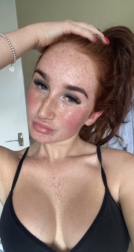 absondabs OnlyFans-Bild