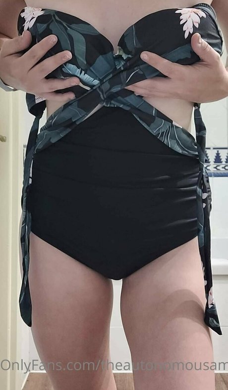 theautonomousamputee2 Nacktbilder geleakt