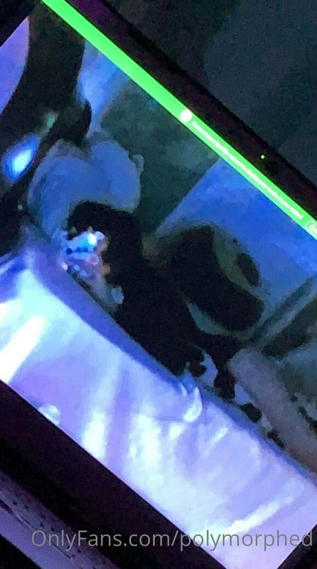 Polymorphed OnlyFans Brüste Bild