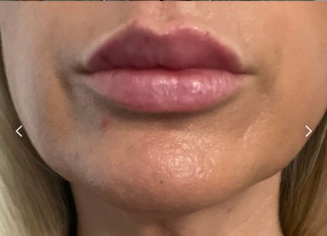 Nipsstrips Oben ohne OnlyFans