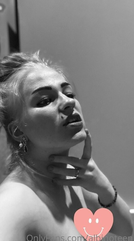 albinoteen Nacktbilder geleakt OnlyFans geleakt