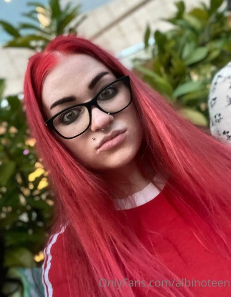 albinoteen Nacktbilder von OnlyFans geleakt