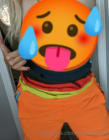 theradicalfox OnlyFans X