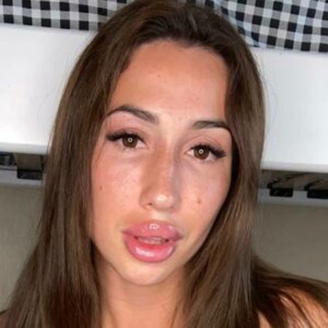 radacatt Po OnlyFans