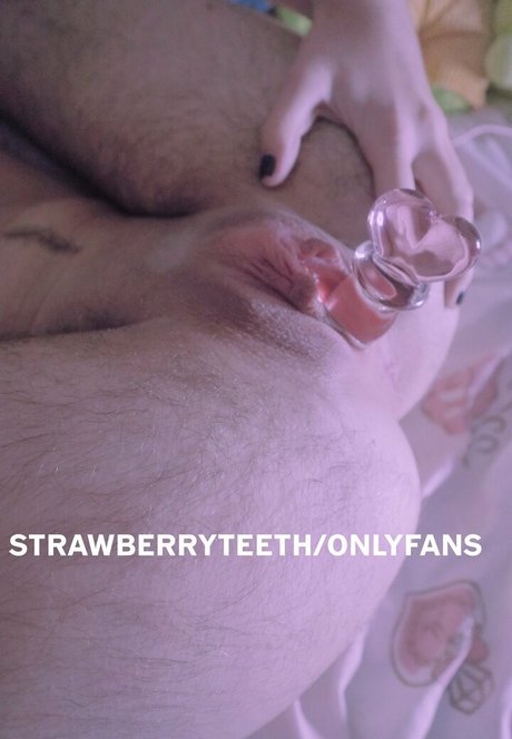 strawberryteeth XXX Leak OnlyFans