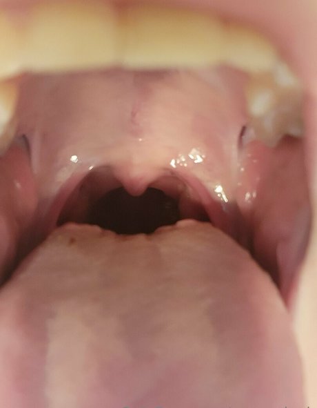 emmydook Nacktbilder OnlyFans