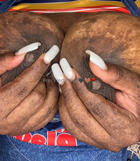 Freckledfantasy5 star erotic gallery