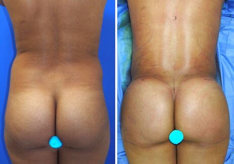 allyiahsface nude star pic