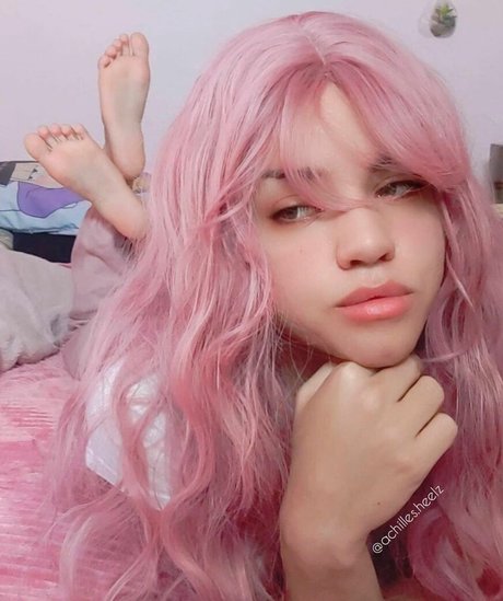 achilles heelz Quick model image