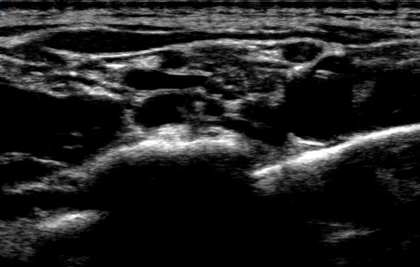 kacenna pornstar nude archive