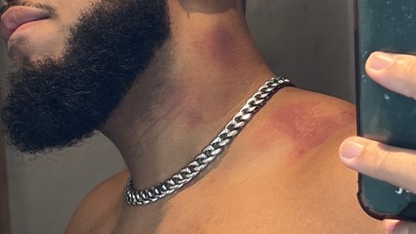 LIL PLUMP_ naked star pic