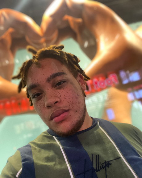 Freckles free model pic