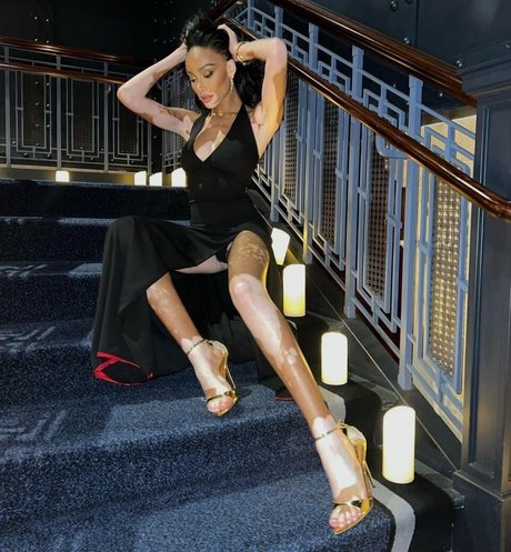 Winnie Harlow model nude gallery