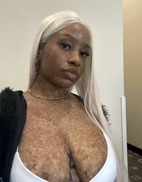 freckledn perfect model image