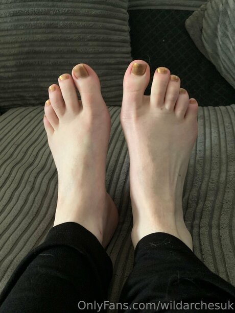 Wildarchesuk model top pic