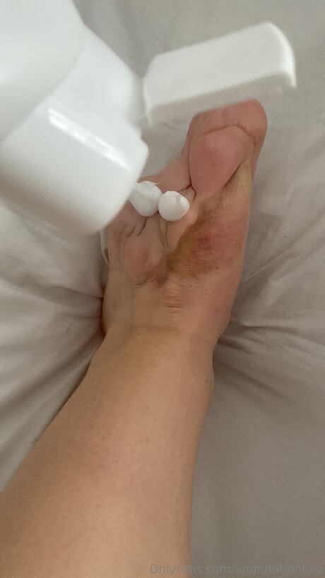 Amputationlula model hd picture