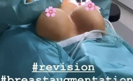 LetzBimbo model erotic pic