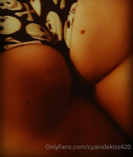 cyanidekiss420 erotic pornstar img