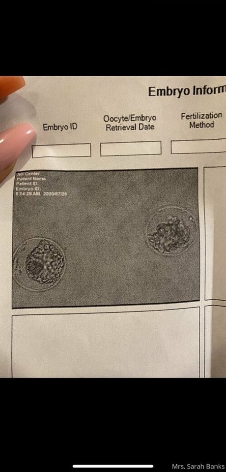 playmate onlyfans art nude img